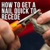 Gently hold the foot, separating the toes. 1