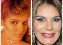 Apenas 2 días después fue llevada a urgencias y hospitalizada en un. Maria Monica Urbina Y Otras Famosas Deformadas Por El Botox Las2orillas