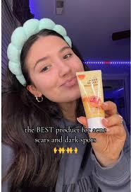 bee venom for the win✨✨✨ the best thing in my skincare routine!!  #creatorsearchinsights #skincare #acnescars #acnetreatment #fyp  #microinfluencer #hairtok #smallcontentcreator #beevenomtherapy