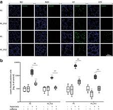 Caffeine is a tiny program that puts an icon in the right side of your menu bar. Antioxidative Effects Of Caffeine In A Hyperoxia Based Rat Model Of Bronchopulmonary Dysplasia Respiratory Research Full Text