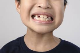 Even though children's teeth are okay to be pulled out (if they are very loose), it's recommended to keep hands out of the mouth as this can. Should I Wiggle A Baby Tooth Pediatric Dental Assistant School Pediatric Dental Assistant School