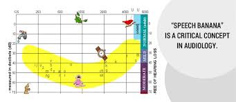 Image result for Audiogram