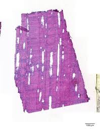 Image result for Dalbergia boehmii