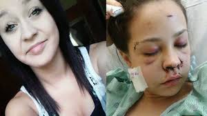 Family of woman shot in face speaks out