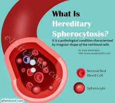 Pin On Genetic Disorders