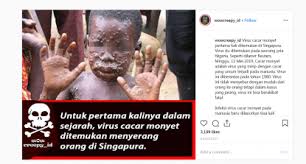 The disease is called monkeypox because it was first identified in laboratory monkeys. This Is Not A Photo Of A Nigerian Man Diagnosed With Monkeypox In Singapore In May 2019 It S An Old Image Of A Congo Child With The Disease Fact Check