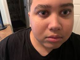 How can they tell if ur in remission