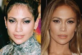 Has Jennifer Lopez had Cosmetic Surgery?