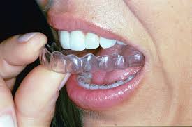 They would say, okay, how long do i have to wear my retainers? Retainers After Invisalign Advanced Cosmetic Dentistry