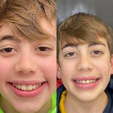 Dr Giorgia Buffa-ortodonzia