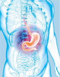 胃癌（stomach cancer、gastric cancer）是發生在胃部黏膜的癌症。 早期的症狀包括胃灼熱，上腹疼痛，惡心及食慾不振。 症狀與消化性潰瘍類似，是導致延誤就醫與高死亡率的原因，但其痛感與潰瘍還是有些許差異，胃潰瘍. å¤šç®¡é½Šä¸‹æŠ—æˆ°èƒƒç™Œæœ«æœŸå»¶å­˜æ´» æ˜Žå ±å¥åº·ç¶²