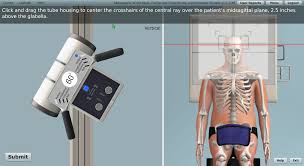 Radiography Procedures Radiography Medical Imaging X Ray
