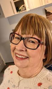 Stunning Phonares 2 multishade Full case at review today. Thanks to my  lovely patient for allowing me to use the photos