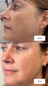 MID OHIO PLASTIC SURGERY (@midohioaesthetics) · Lewis Center, OH