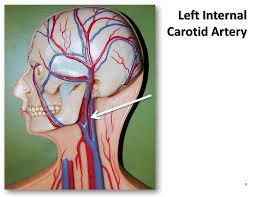 The right and left subclavian arteries give the ascending cervical artery arises from the inferior thyroid artery, as it turns medially in the neck. Left Internal Carotid Artery The Anatomy Of The Arteries Flickr