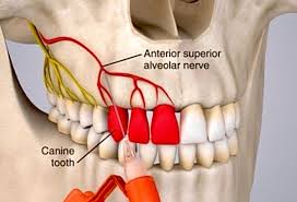 Image result for Periapical Block