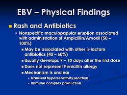 Most people are infected by the virus as children, when the disease produces few or no symptoms. Epstein Barr Virus Epstein Barr Virus Shane C Mcallister Md Phd Shane C Mcallister Md Phd Pediatric Infectious Diseases Fellow Pediatric Infectious Ppt Download