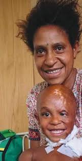 Repairing bodies and rebuilding lives in the Asia Pacific region