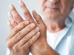 Maybe you would like to learn more about one of these? What Are The Signs Dupuytren S Contracture Is Progressing