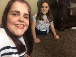 Ask us questions about us being conjoined! We will be doing a Q & A for our  YouTube channel! Comment