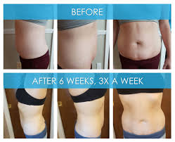 The number one similarity between the two is that they both help in fat reduction. Laser Like Lipo