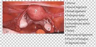 30 cm long abdominal part: The Female Pelvis Anatomy Exercises Laparoscopy Uterosacral Ligament Pelvis Anatomy Human Body Disease Png Klipartz