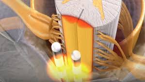 Pin On Medical Treatments