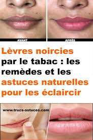 Pin On Astuces Sante Et Bien Etre