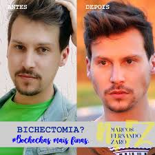 O procedimento se popularizou ainda mais nos anosde 2015 e 2016, por conta da adesão de tantos famosos que. Bichectomia Procedimento Rapido E Facil Para Bochechas Mais Finas Marcos Fernando Zaro Moda Masculina Beleza E Saude