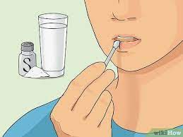 How To Heal A Swollen Lip: 15 Steps (With Pictures) - Wikihow