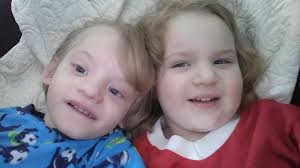 Send love to Liam: Rahway boy with rare condition adores getting cards