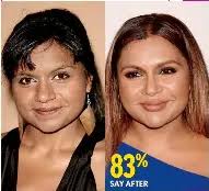 Mindy Kaling ruined her face with so much plastic surgery. :  r/unpopularopinion