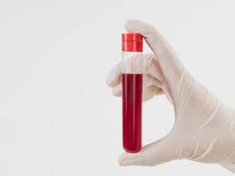 We did not find results for: Blood Donation Its Benefits Side Effects What To Do Before During And After Donating Blood 247 News Around The World