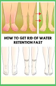 You probably need to reduce your sodium intake. 12 Simple Remedies To Avoid Water Retention In Your Body Shape Your Body In 2020 Water Retention Remedies Swollen Feet Remedy Foot Remedies