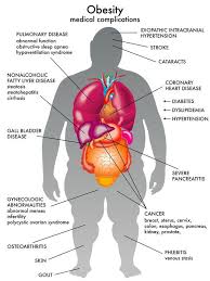 Pin On Overweight And Incontinence