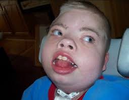 Jacob Abels Obituary