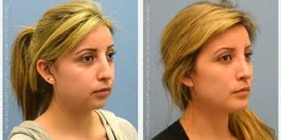 Douglas Hendricks, MD, Board Certified Plastic Surgeon