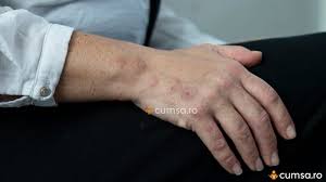 Acest tip de insecte se hranesc cu sange. Plosnite De Pat Cum Sa Identifici O Infestare In Casa Ta Cumsa Ro