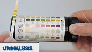 Urinalysis Osce Guide