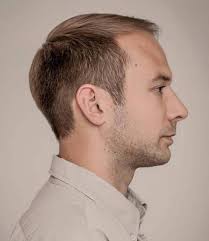 1001 Idees Coupe De Cheveux Homme Degarni Finir En Beaute Coupe Cheveux Homme Coupe Homme Cheveux Fins Cheveux Homme