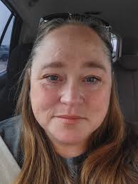 Is liquid diet normal 3 weeks post gastric bypass?