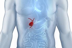 We did not find results for: Gallbladder Disease Drfuhrman Com