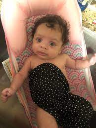 My Baby S Head Is Measuring Small Complications Forums What To Expect