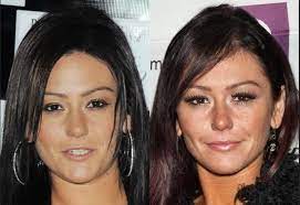 Gone are the days when you could spot somebody who had plastic surgery procedures with ease. Jwoww Plastic Surgery Photo Before And After Pinterest