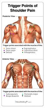 Check spelling or type a new query. Trigger Points Shoulder