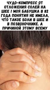 как избавиться от отложения солей на шее в домашних условиях Pin Na Doske Zdorove I Krasota
