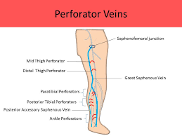 Musculus gastrocnemius) is a superficial muscle of the posterior group of the lower leg muscles. Ultrasound Registry Review Extremity Venous