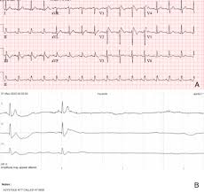 stage_id=2071-checksum=efa9882596c31b6a7fa97ebb60e04a5ce3cf6fb8