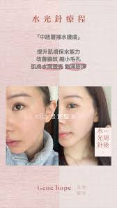 Gene hope｜景賀醫美