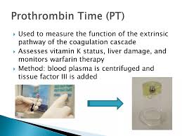 Image result for Prothrombin Time